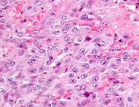 Epithelial cells