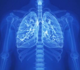 Glowing blue X-ray lungs Glowing blue X-ray lungs