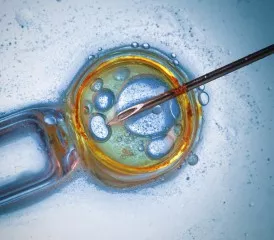 Stem cell Stem cell