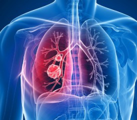 Blue and red illustration of lungs