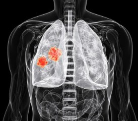 Illustration of lungs Illustration of lungs