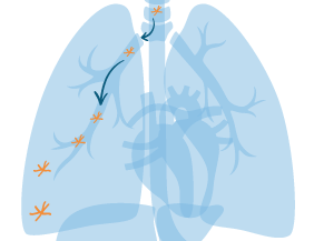 Asbestos fibers entering the lungs