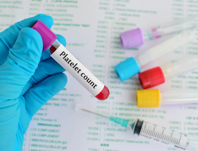 Test tube with platelet count label Test tube with platelet count label