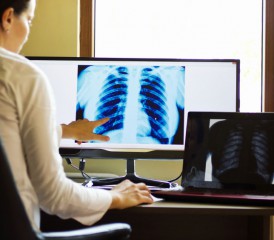 Doctor reviews a patient’s chest X-ray Doctor reviews a patient’s chest X-ray