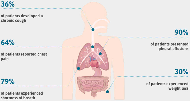 Mesothelioma Symptoms: Asbestos Cancer Warning Signs