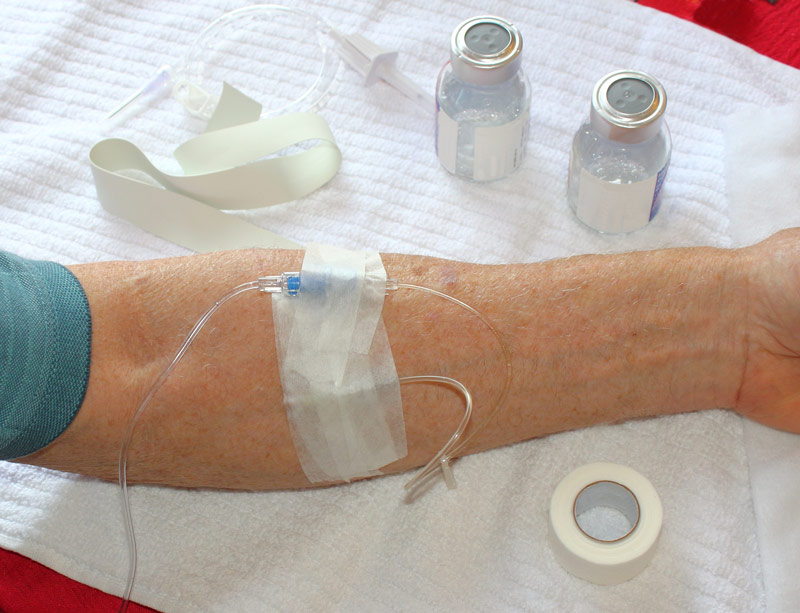 systemic-chemotherapy systemic-chemotherapy