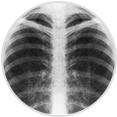 X-Rays